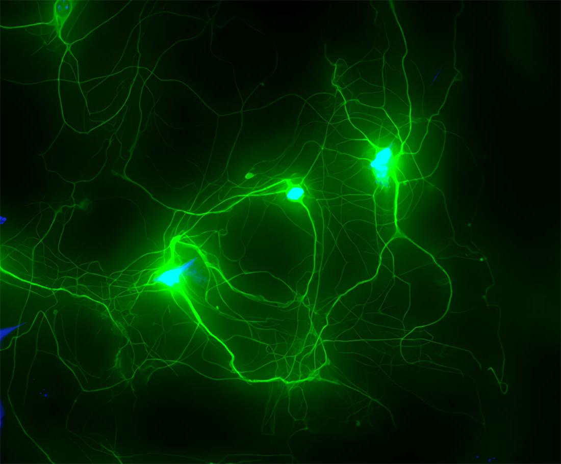 2022 photo contest round 2 Growing Human Neurons